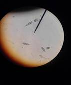 Description: D:\JUCAVM files\Mycology\MINI PROJ\lab photos\Camera\IMG_20170128_110721.jpg